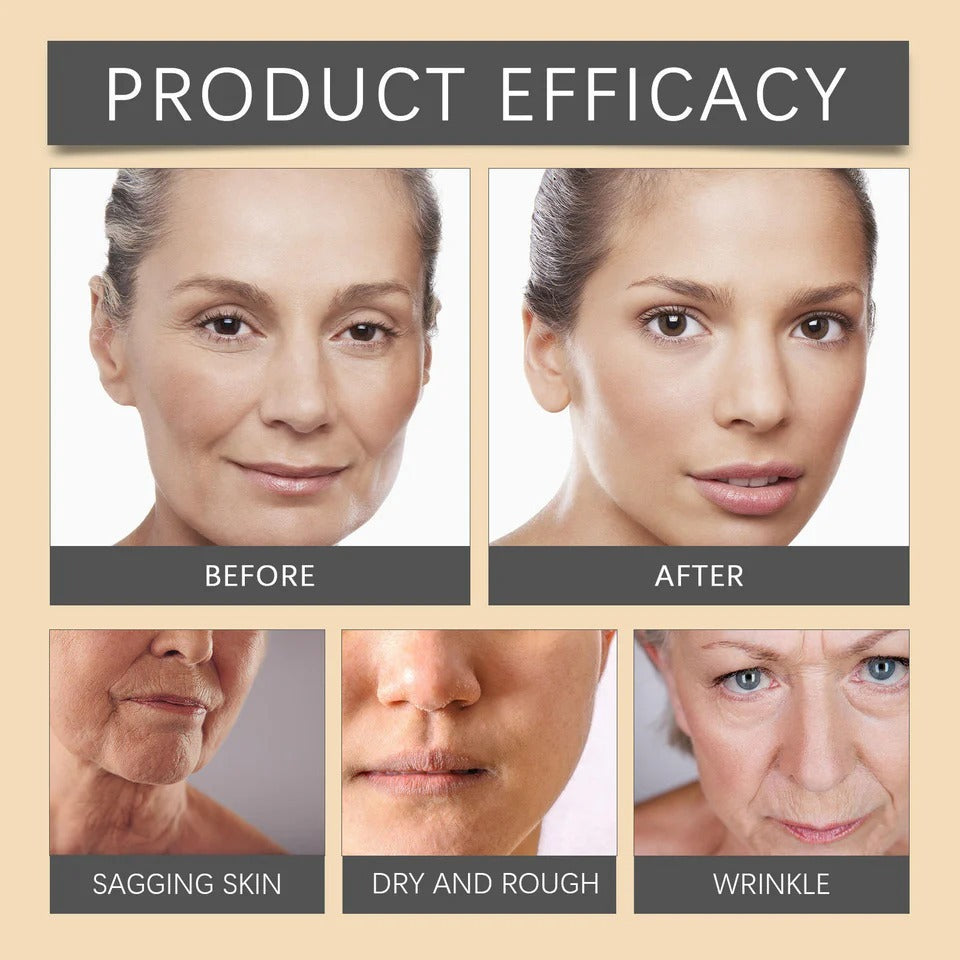 Whitening & Moisturizing Botox Facial Care Cream