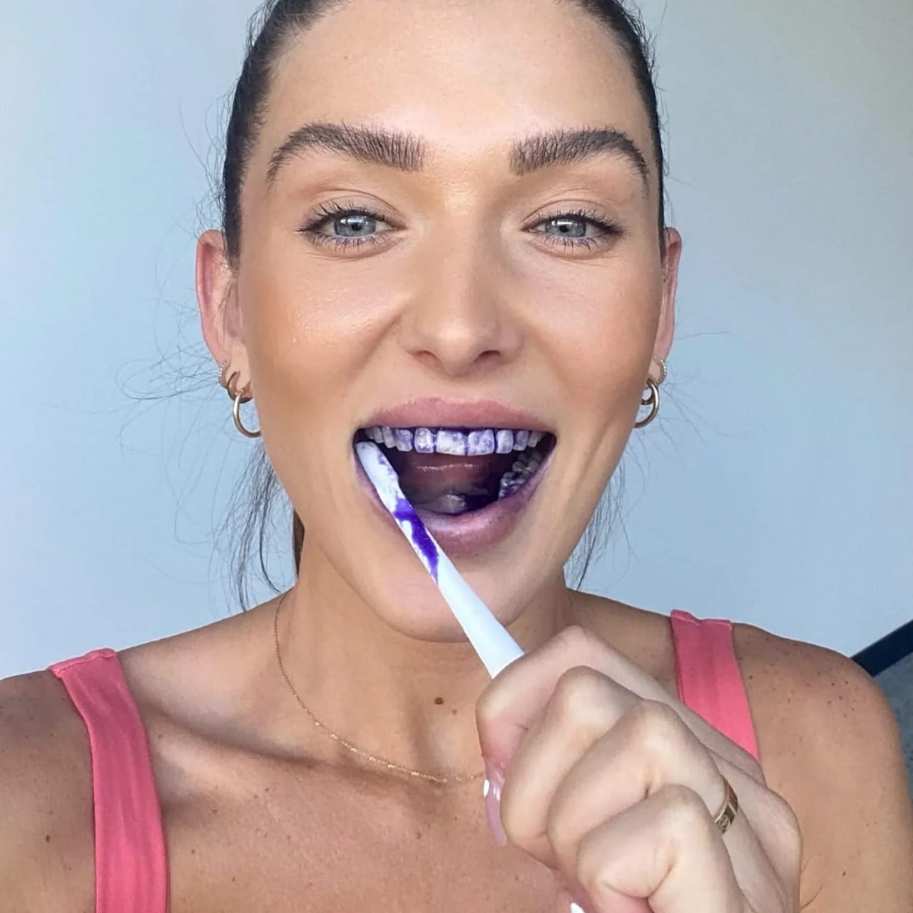 Hismile V34 Teeth Whitening
