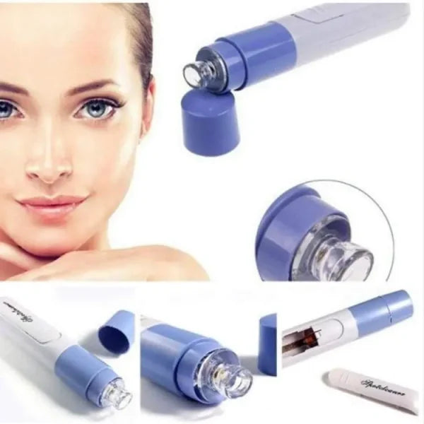 New Electric Blackhead Remover