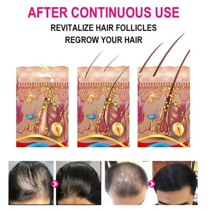 Anti-Grey Hair Serum