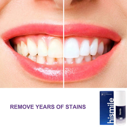 Hismile V34 Teeth Whitening