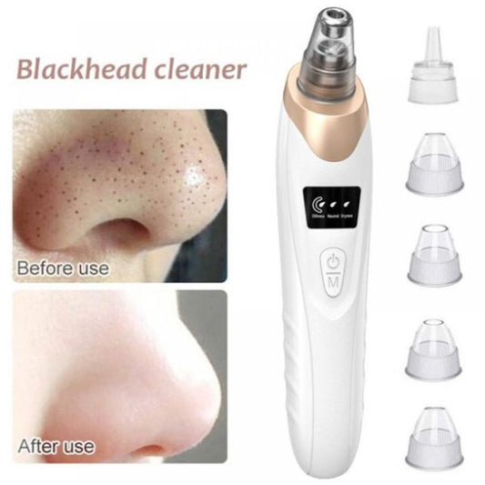 Vacuum Suction Blackhead Remover