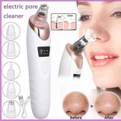 Vacuum Suction Blackhead Remover